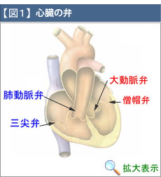 疾患紹介|兵庫医科大学 心臓血管外科