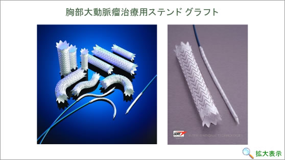 胸部大動脈瘤治療用ステンドグラフト
